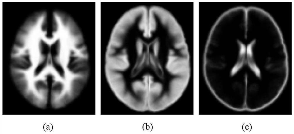 A Brain Tissue Segmentation Method Based on Regularized Graph Cut