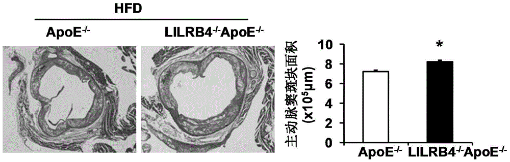 Function and application of leukocyte immunoglobulin-like receptor subfamily b member 4 in the treatment of atherosclerosis