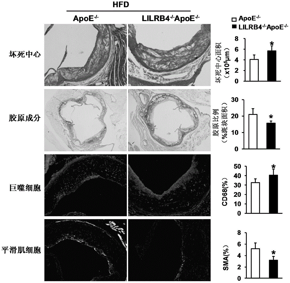 Function and application of leukocyte immunoglobulin-like receptor subfamily b member 4 in the treatment of atherosclerosis