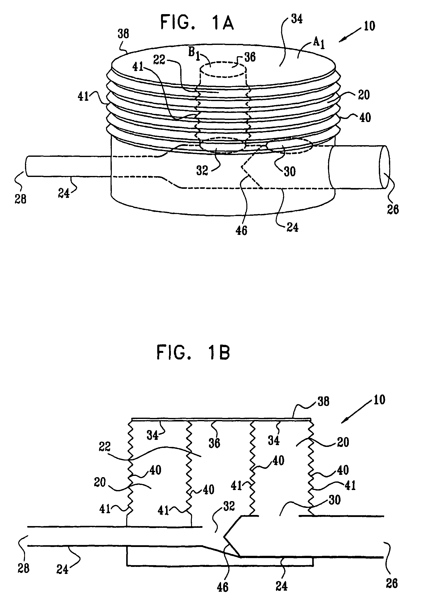 Extracardiac blood flow amplification device