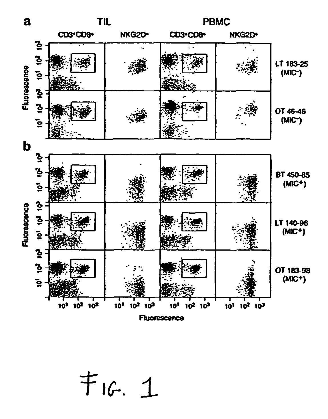 Soluble MIC polypeptides as markers for diagnosis, prognosis and treatment of cancer and autoimmune diseases or conditions
