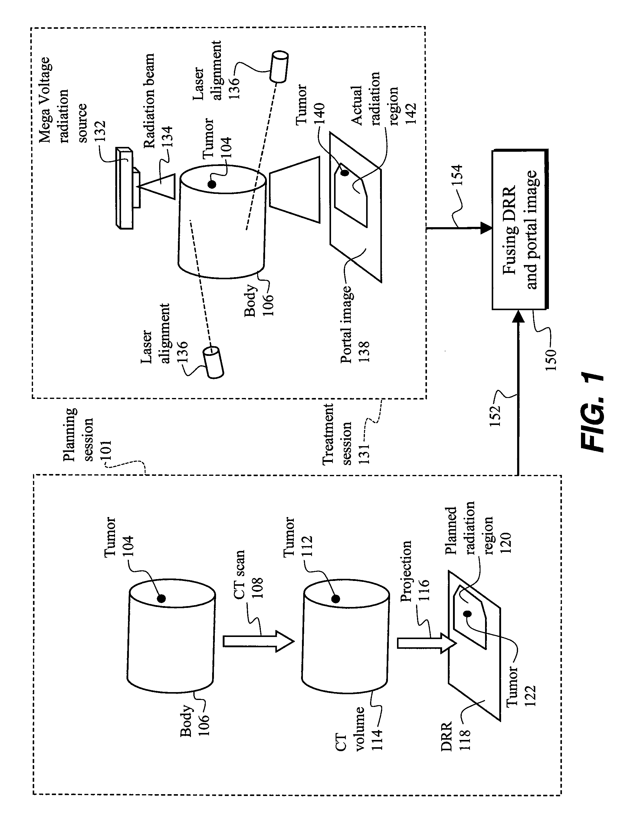 Method and system of image fusion for radiation therapy