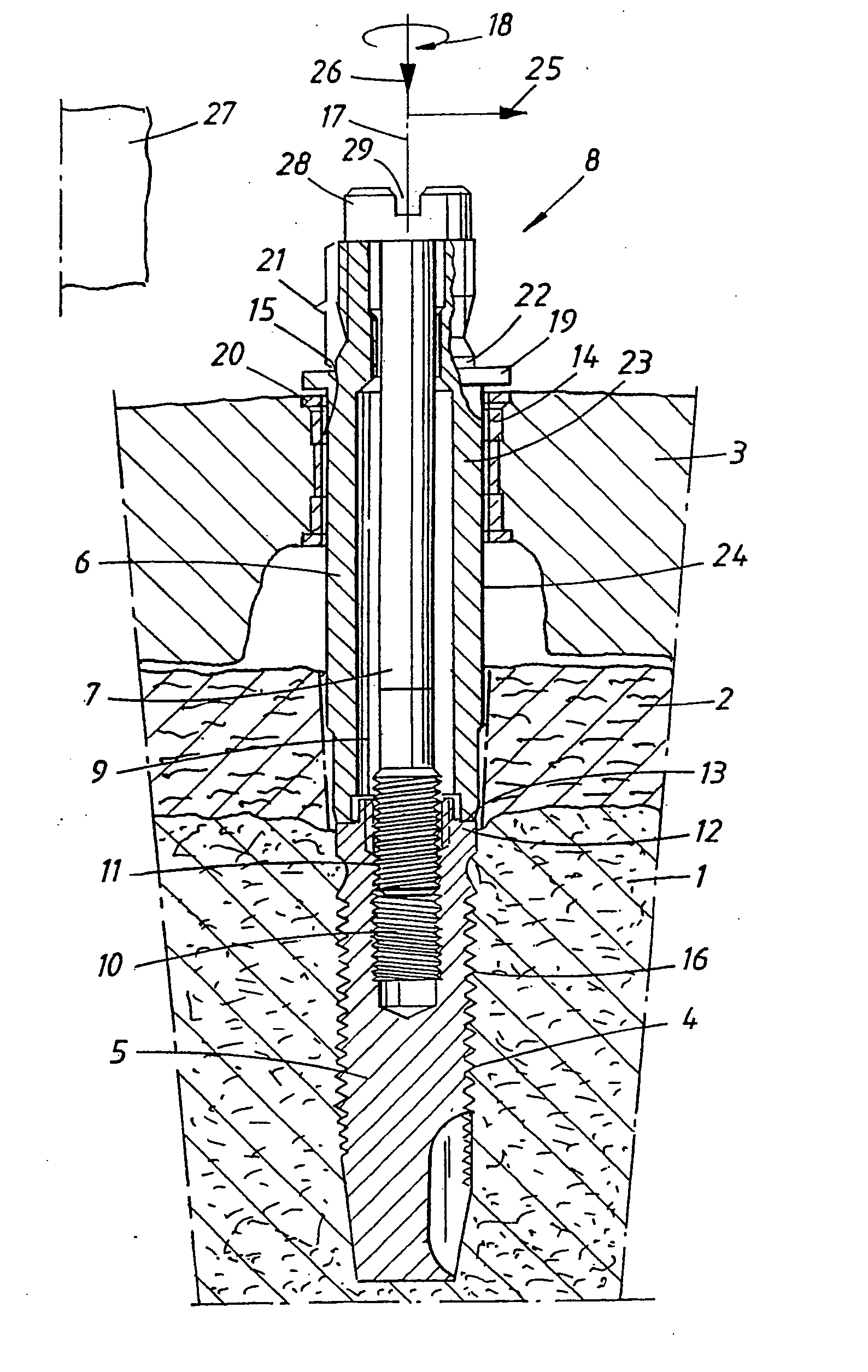 Device and arrangement for fixture installation