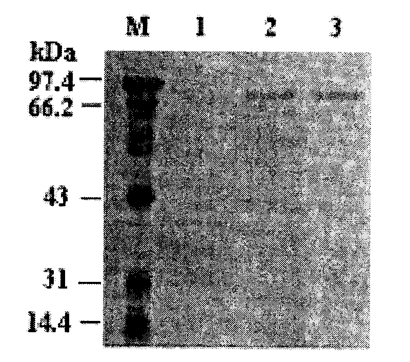 Mutated housefly acetylcholinesterase gene and expression thereof