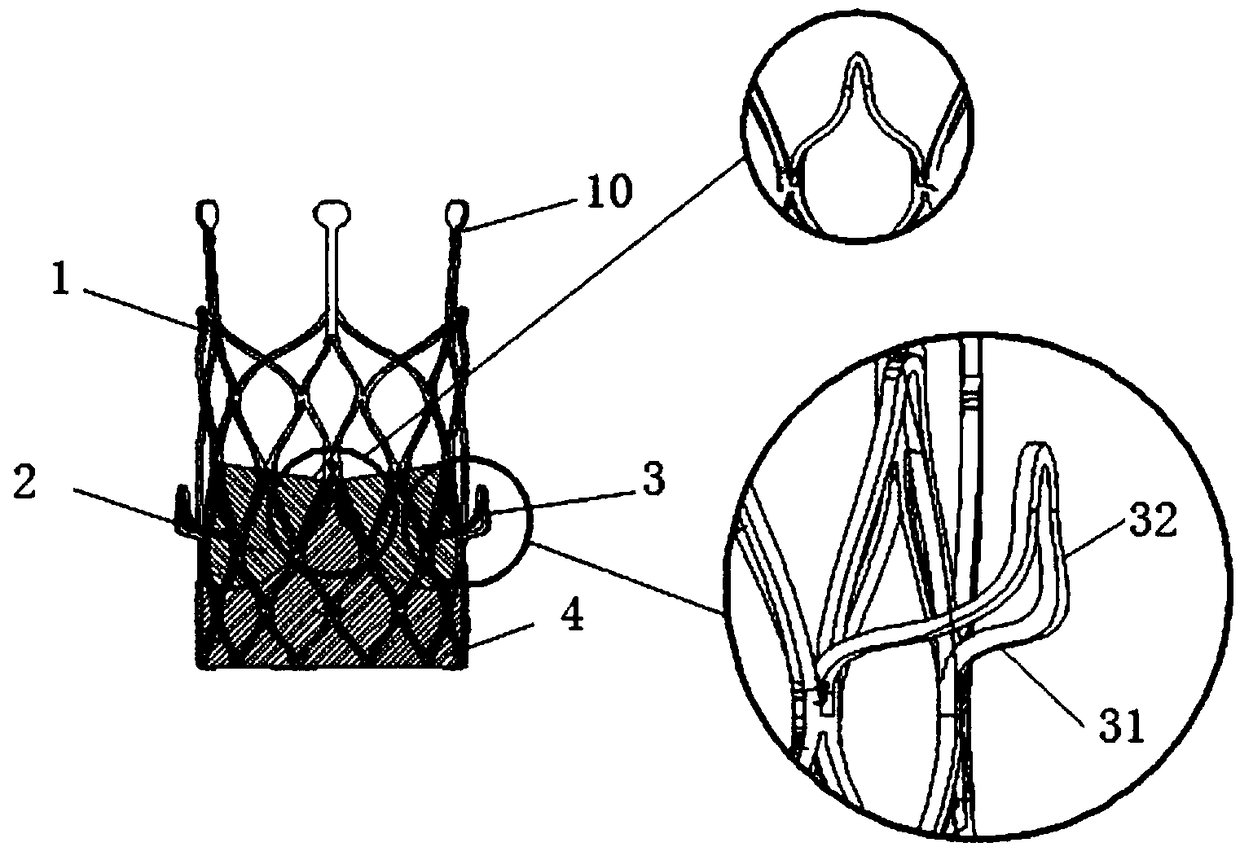 Heart valve prosthesis