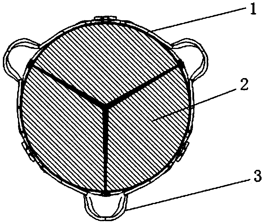 Heart valve prosthesis