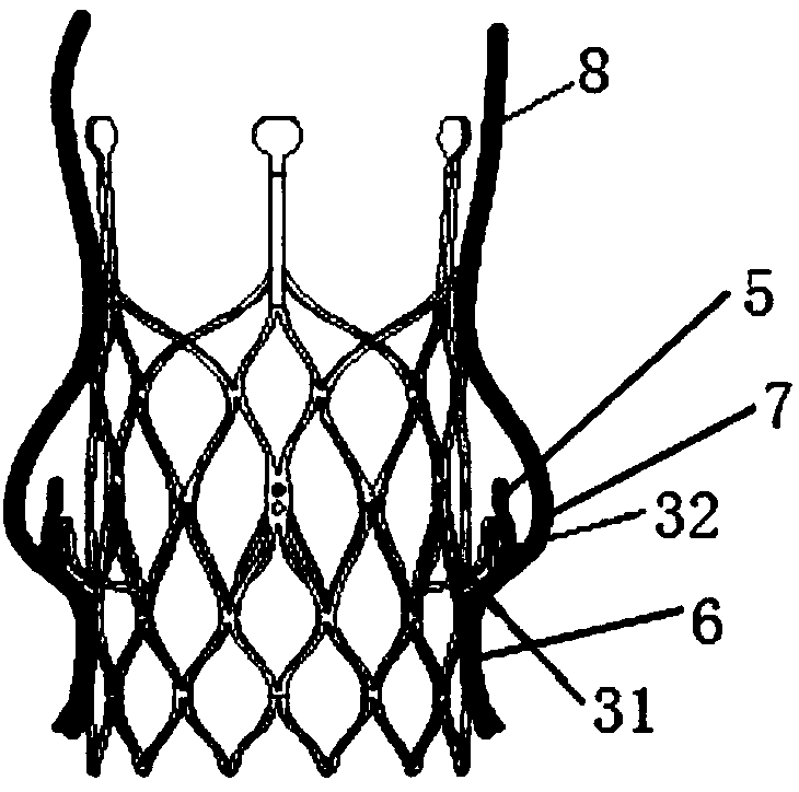 Heart valve prosthesis