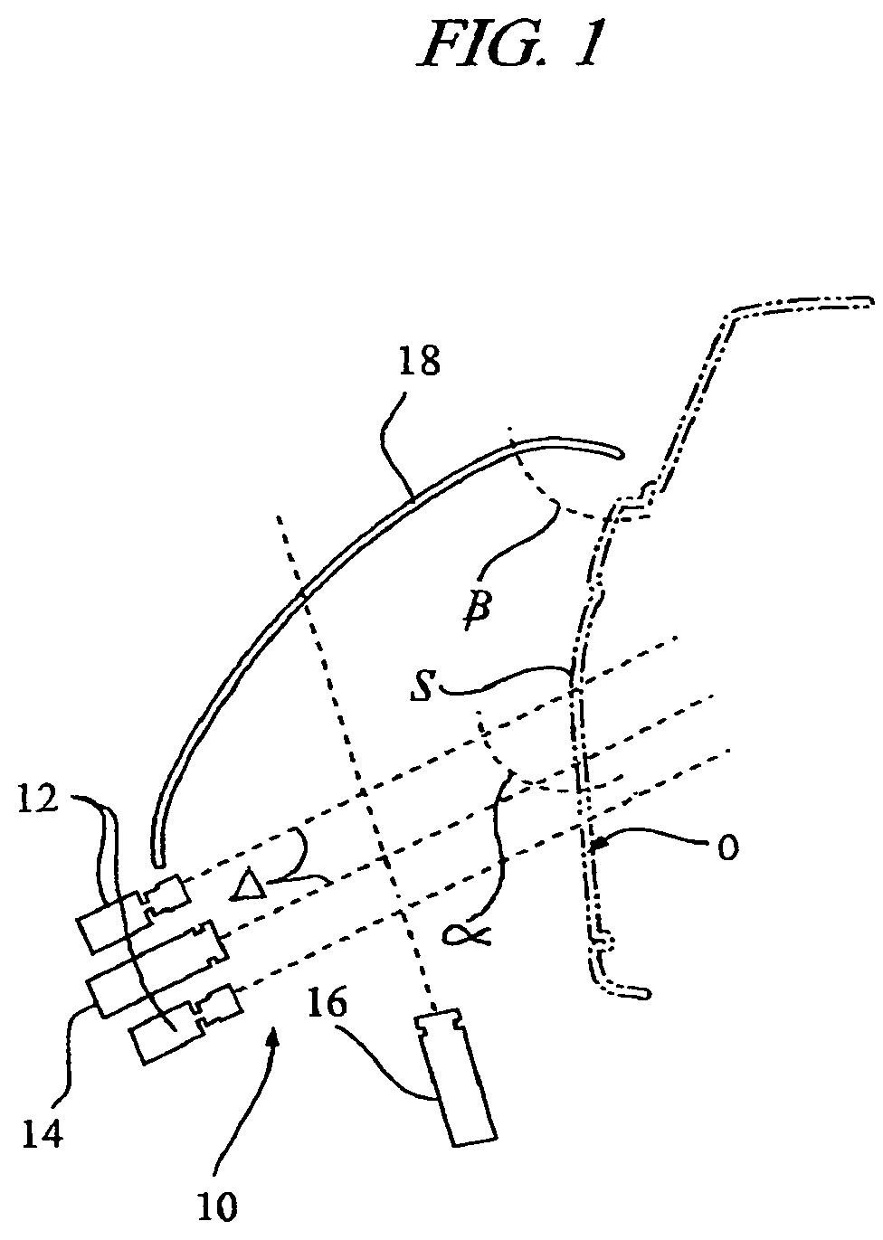 Hybrid 3D optical scanning system