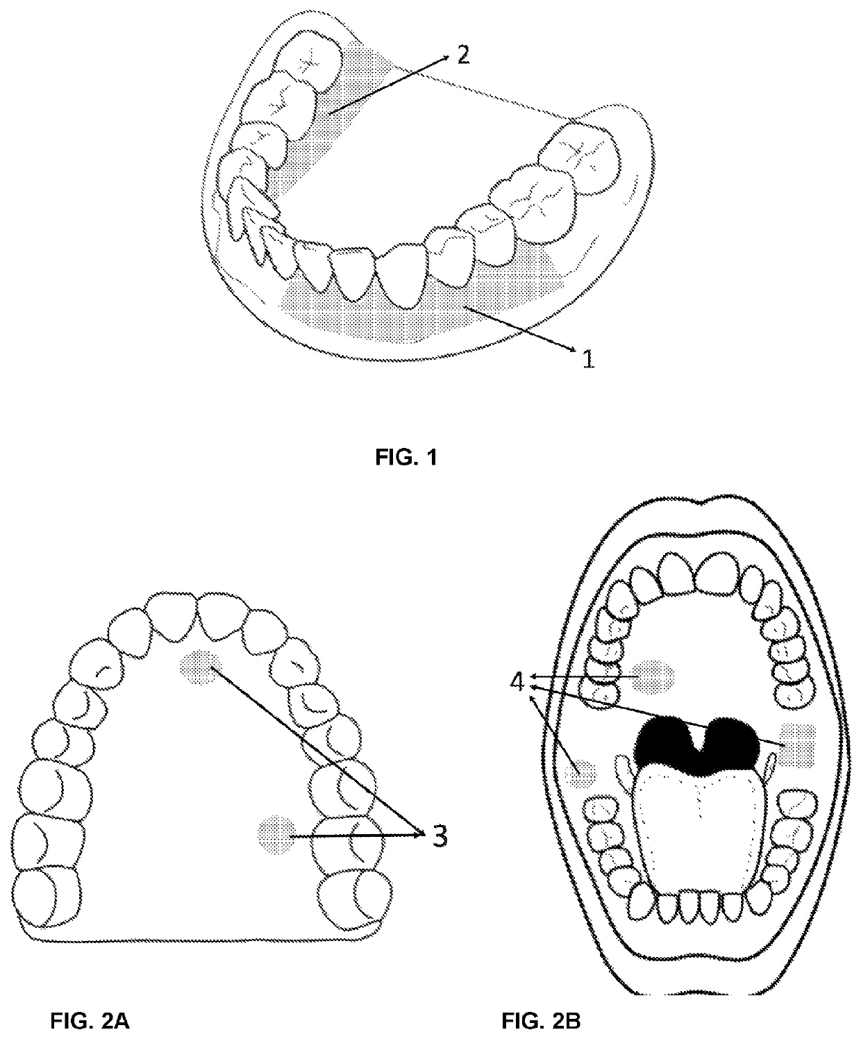 Filmogenic compositions for topical anaesthetic bioadhesives—tabs, for controlled release of active principles and topical anaesthetic bioadhesives