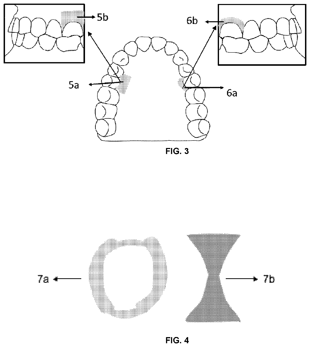 Filmogenic compositions for topical anaesthetic bioadhesives—tabs, for controlled release of active principles and topical anaesthetic bioadhesives