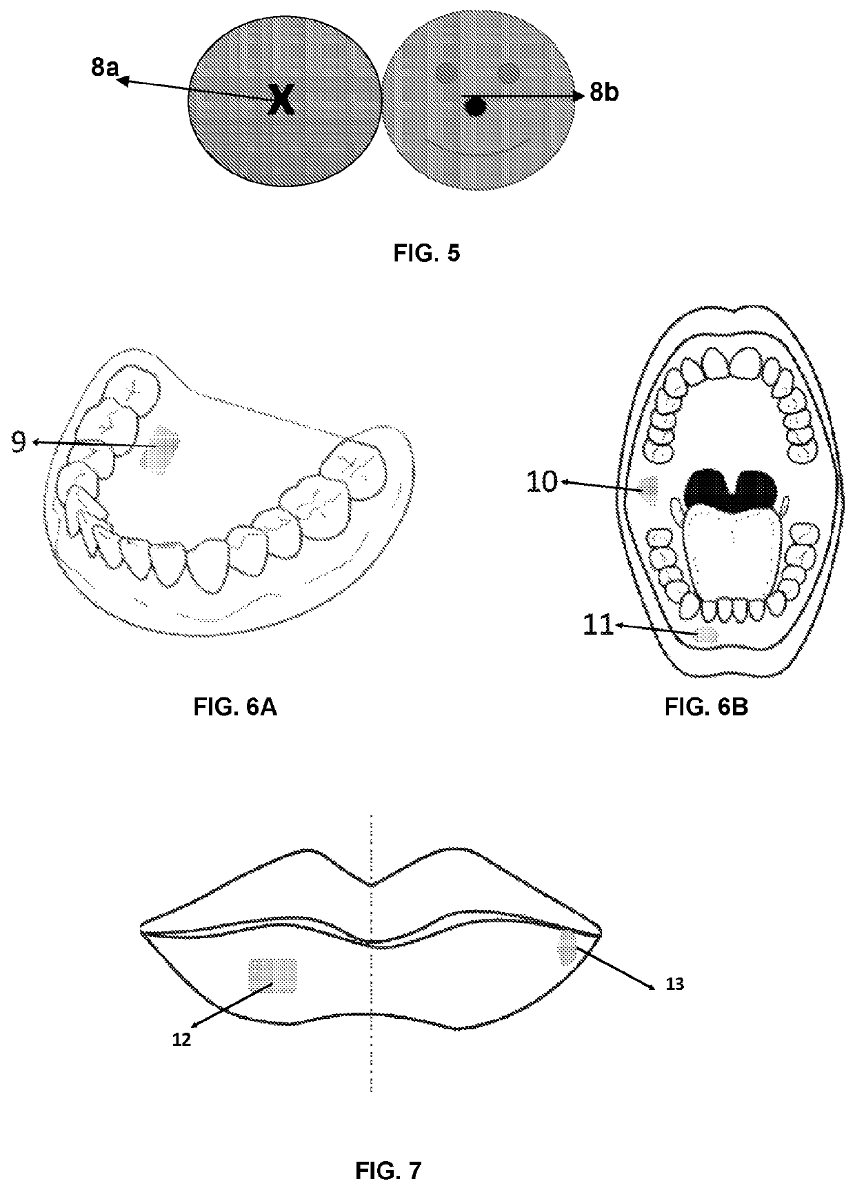 Filmogenic compositions for topical anaesthetic bioadhesives—tabs, for controlled release of active principles and topical anaesthetic bioadhesives