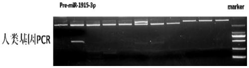 Use of nucleic acid in improving cell megakaryotic differentiation efficiency