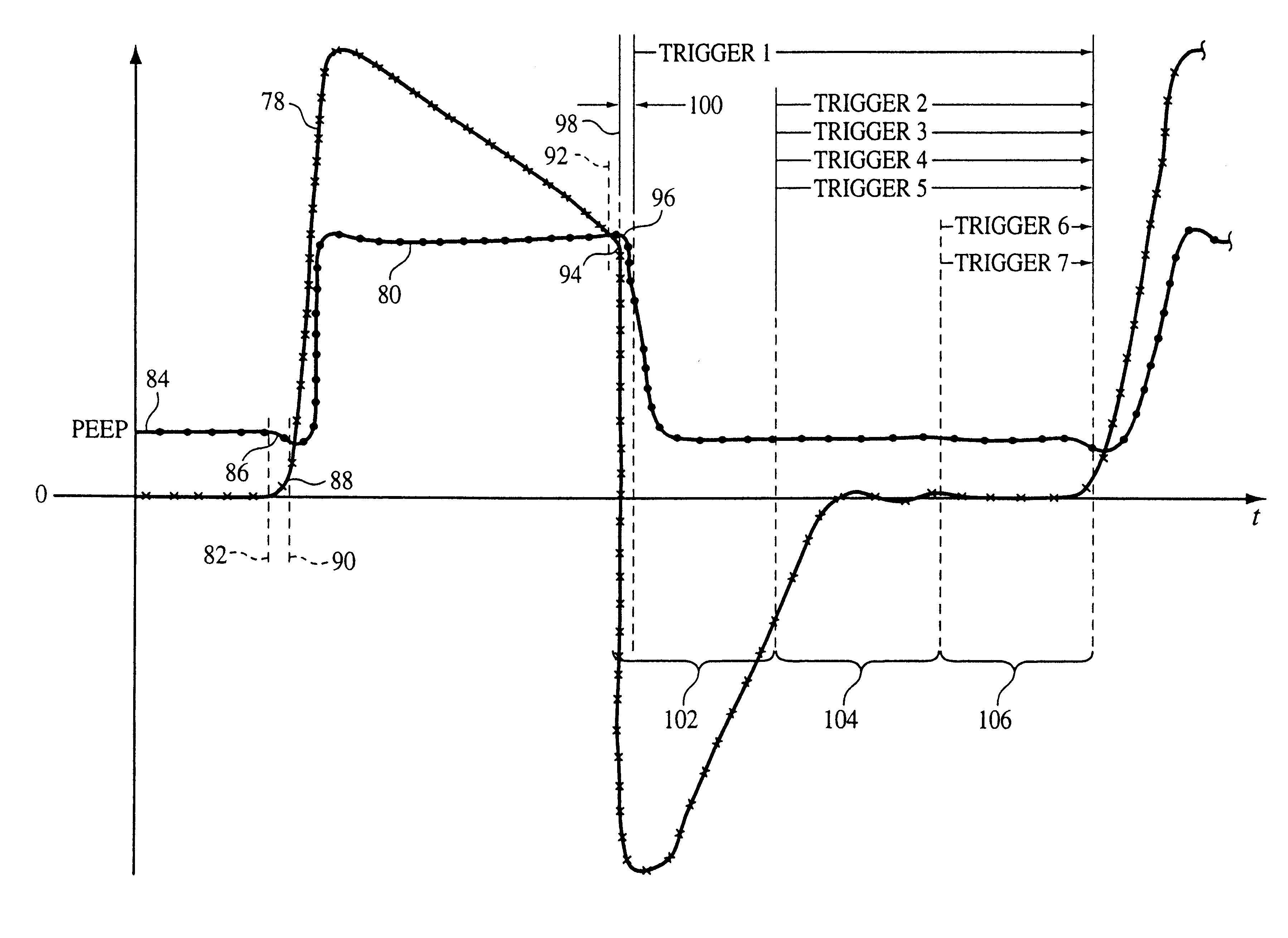 Medical ventilator triggering and cycling method and mechanism