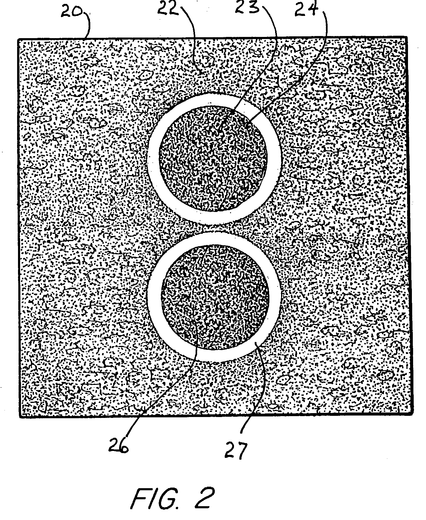 System and method for improving ultrasound image acquisition and replication for repeatable measurements of vascular structures
