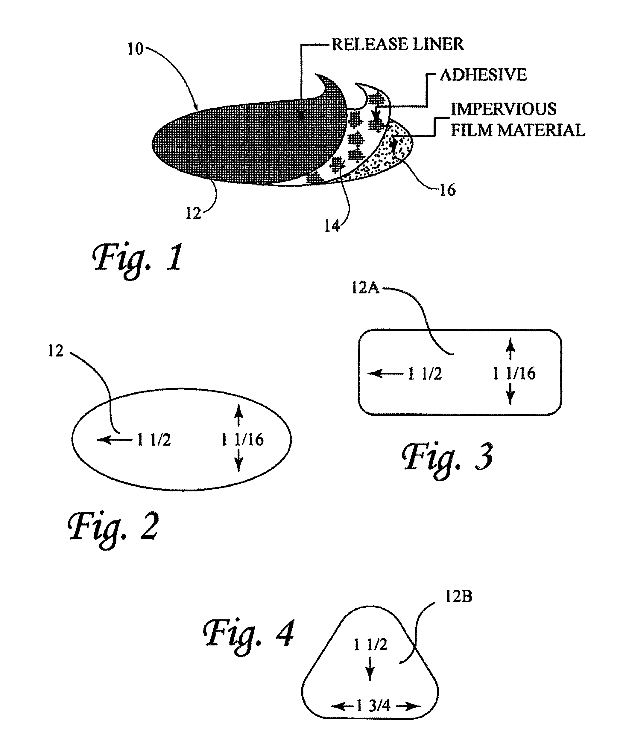 Method and device for female urinary incontinence