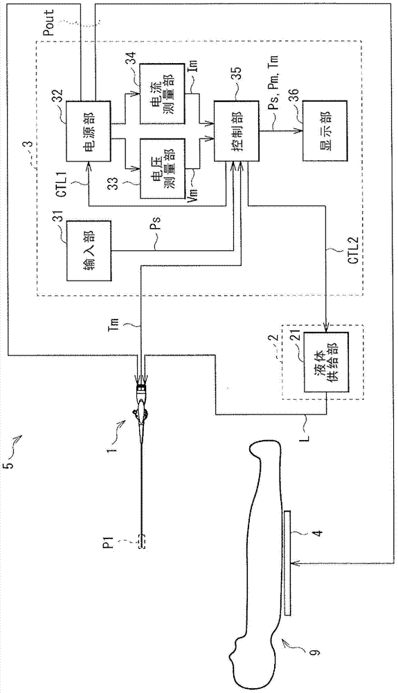 catheter system