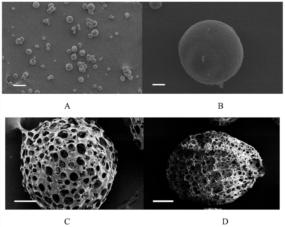 Injectable medicated particle-inlaid porous composite microsphere preparation and preparation method thereof
