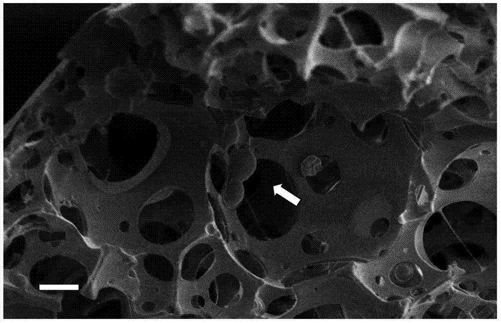 Injectable medicated particle-inlaid porous composite microsphere preparation and preparation method thereof