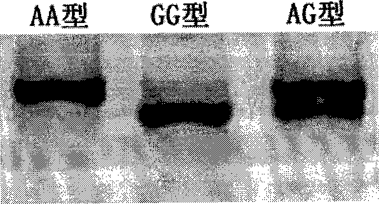 Method and reagent kit for forecasting outbreak age of carcinoma of colon