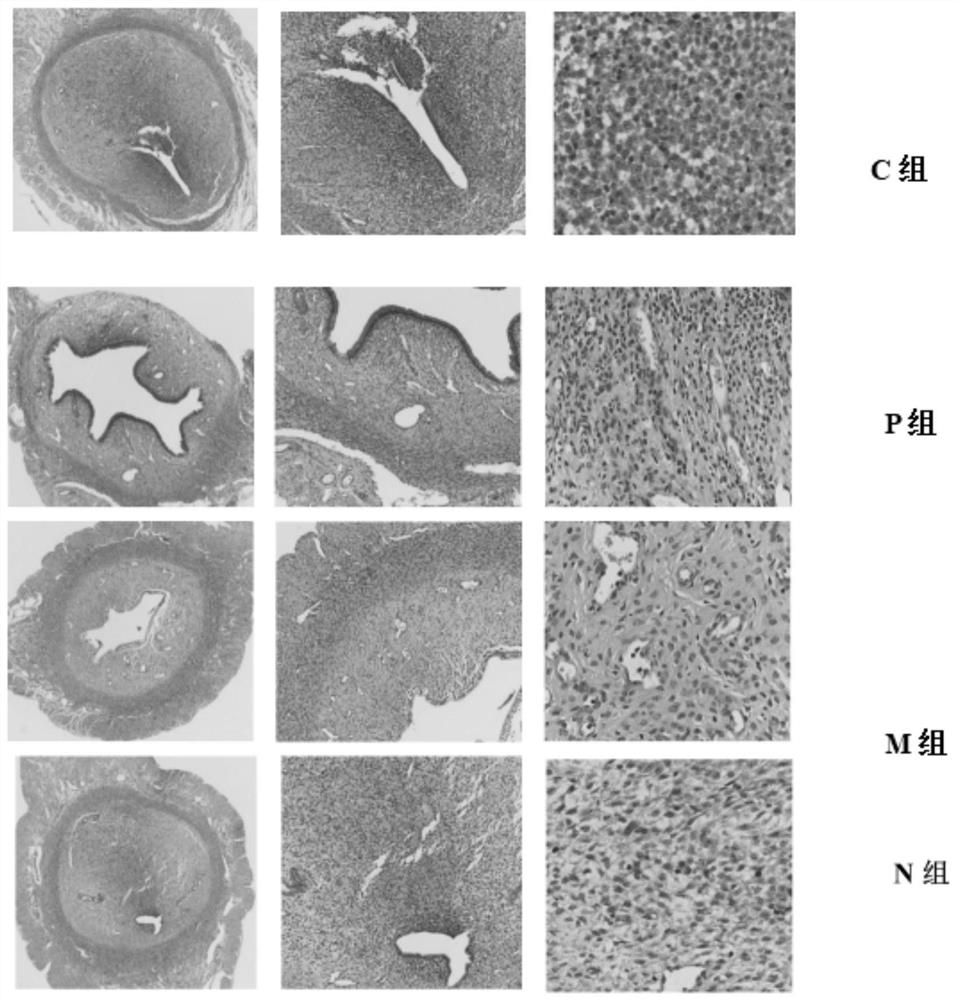 A traditional Chinese medicine composition for treating embryo recurrent implantation failure diseases and its application
