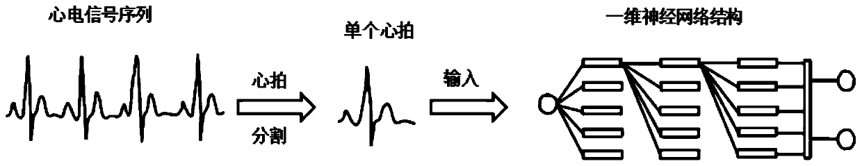 A ventricular ectopic beat detection method based on 1d convolutional neural network