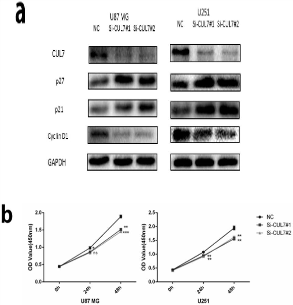 Application of cul7 in diagnosis, treatment and prognosis of glioma