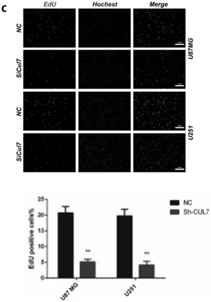 Application of cul7 in diagnosis, treatment and prognosis of glioma