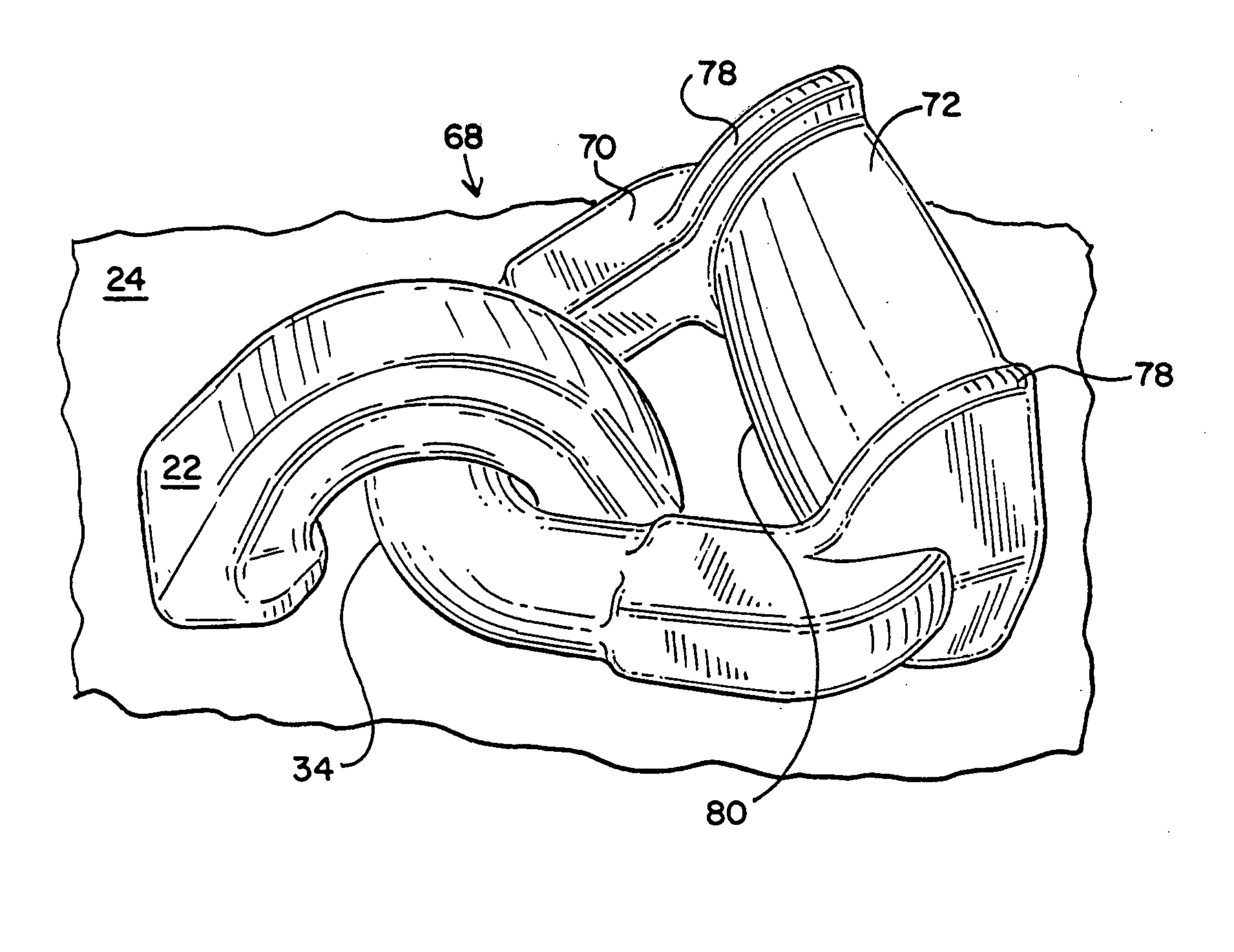 Lading tie anchor link with enhanced banding contact surface