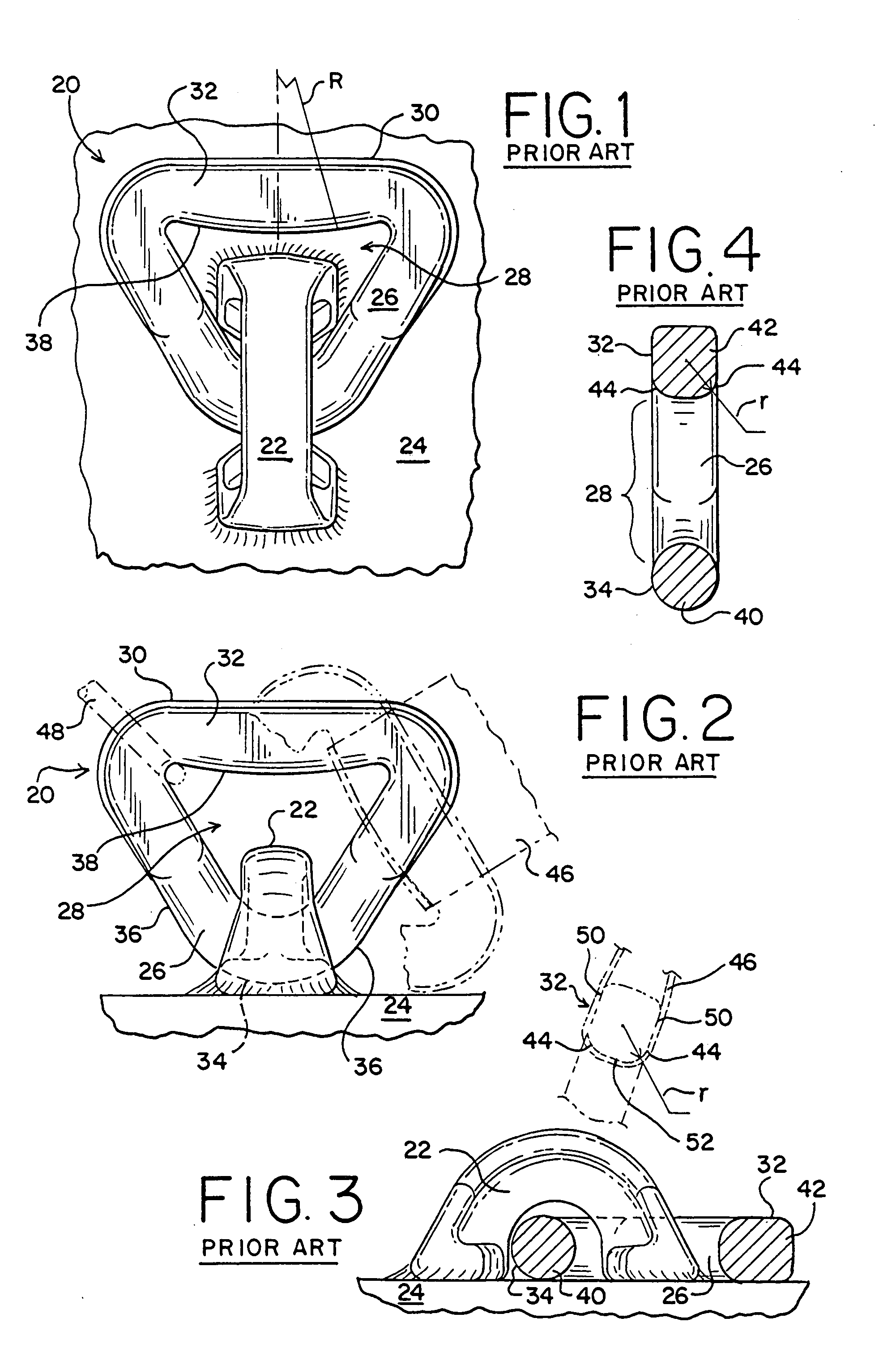 Lading tie anchor link with enhanced banding contact surface