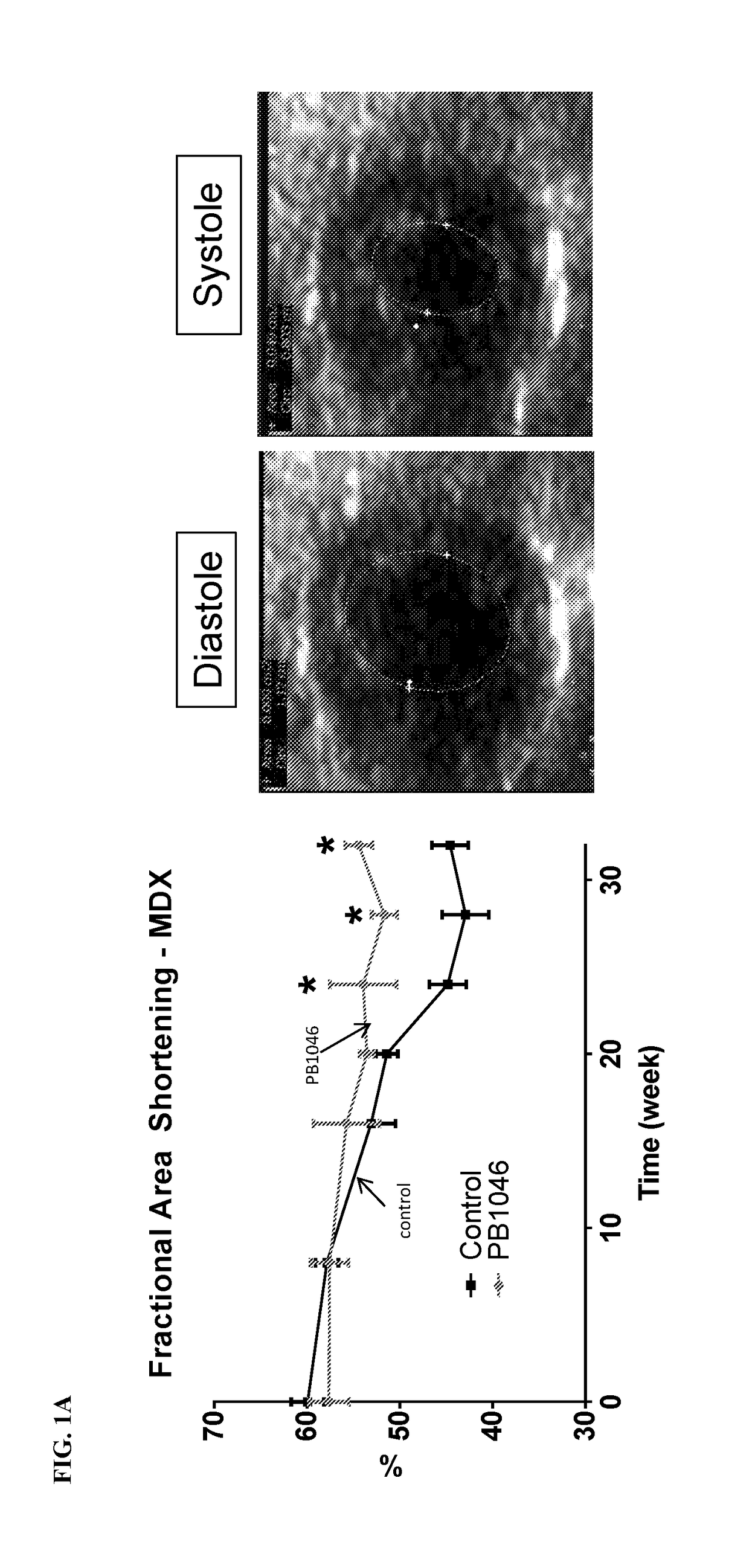 Methods and compositions for treating muscle disease and disorders