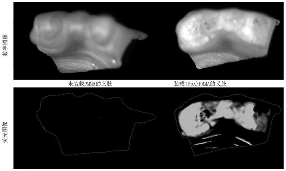 Functionalized prosthetic interfaces for prevention and treatment of dental conditions