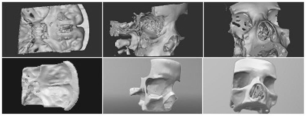 3D printing-based medical model and its manufacturing method