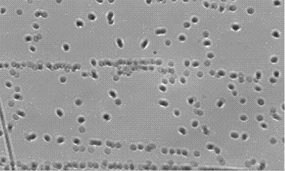 Application of caragana korshinskii extract in preparing medicine for treating and preventing skin tinea