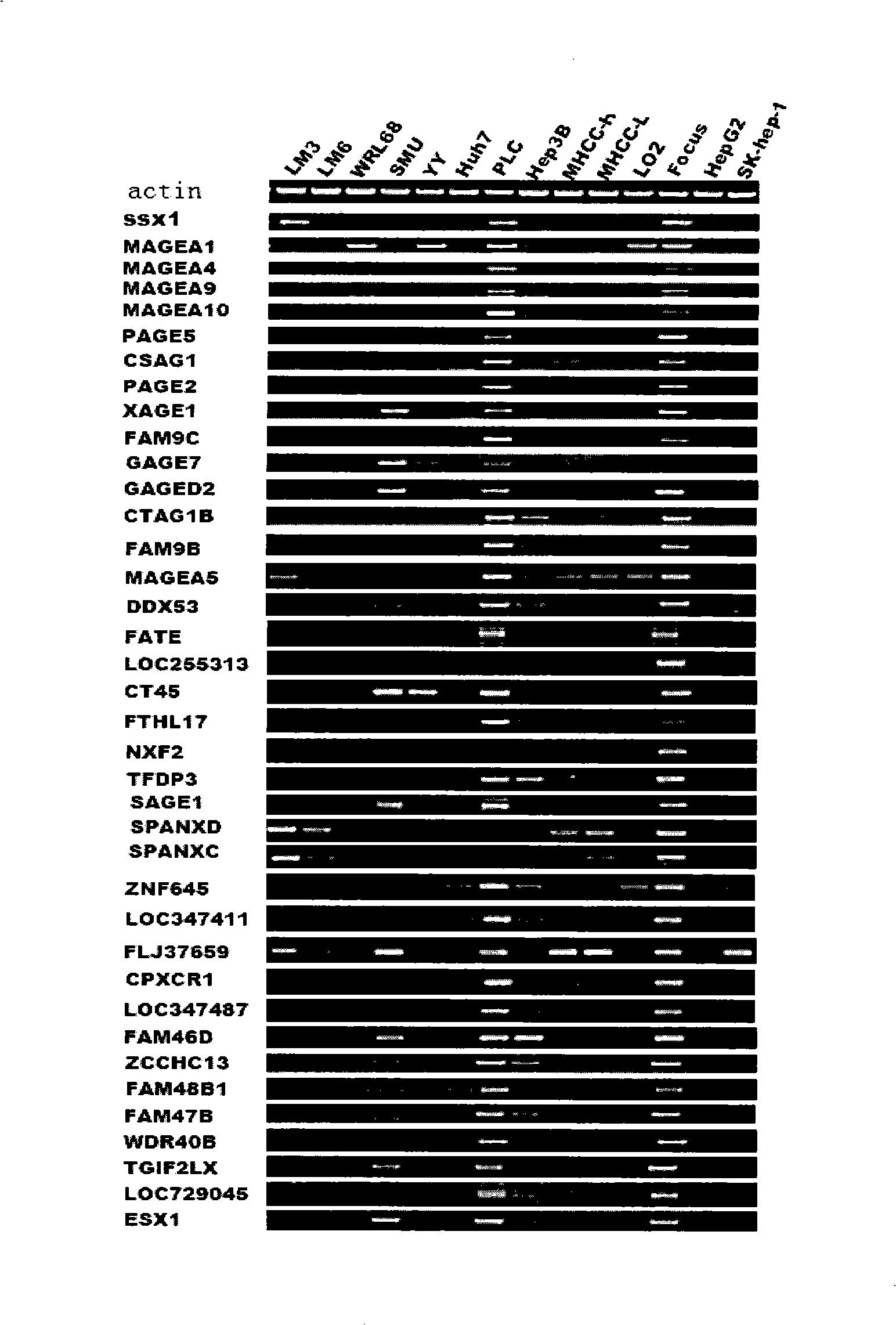 Uses of DUSP21 gene