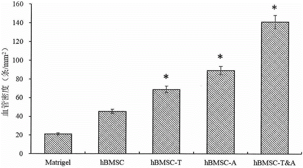Preparation method and kit of human stem cell with prolonged service life and enhanced angiogenesis