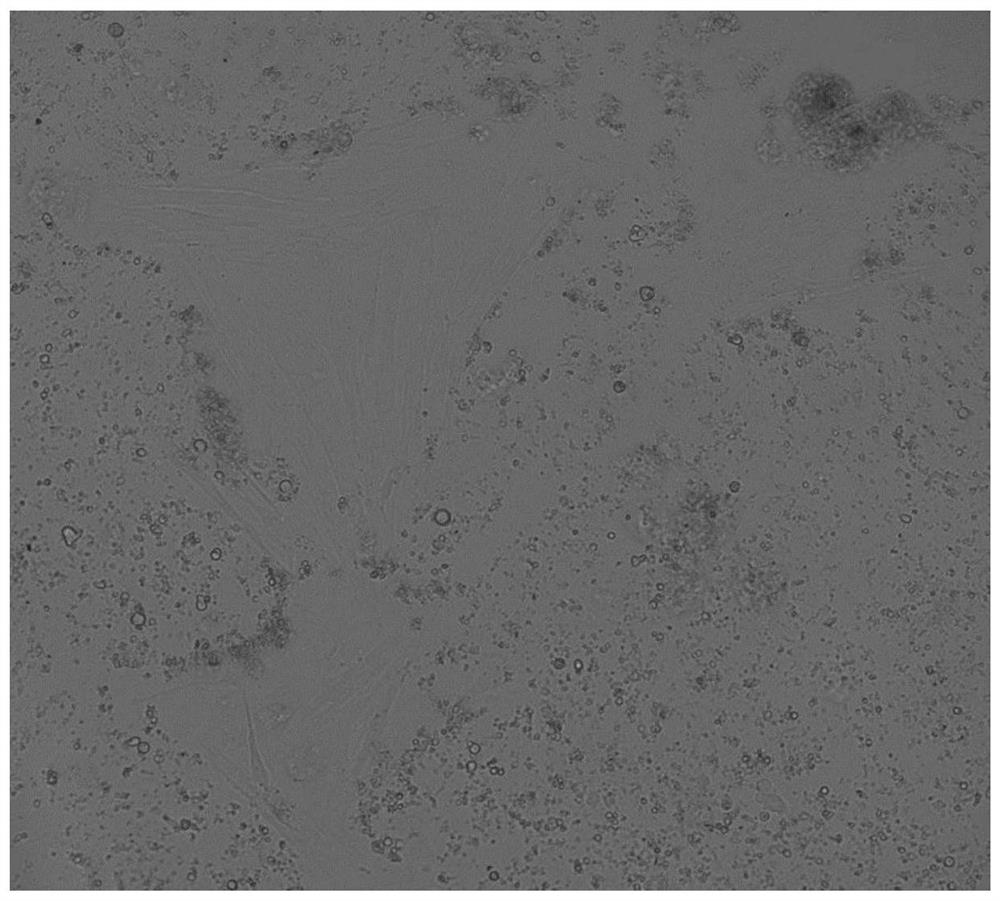 Establishment of carp brain cell line and its establishment method and application