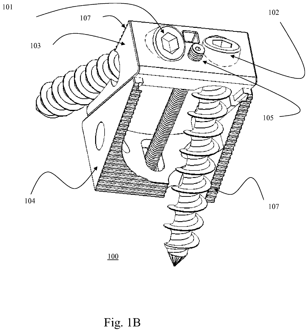 Bi-directional fixating transvertebral body screws and posterior cervical and lumbar interarticulating joint calibrated stapling devices for spinal fusion