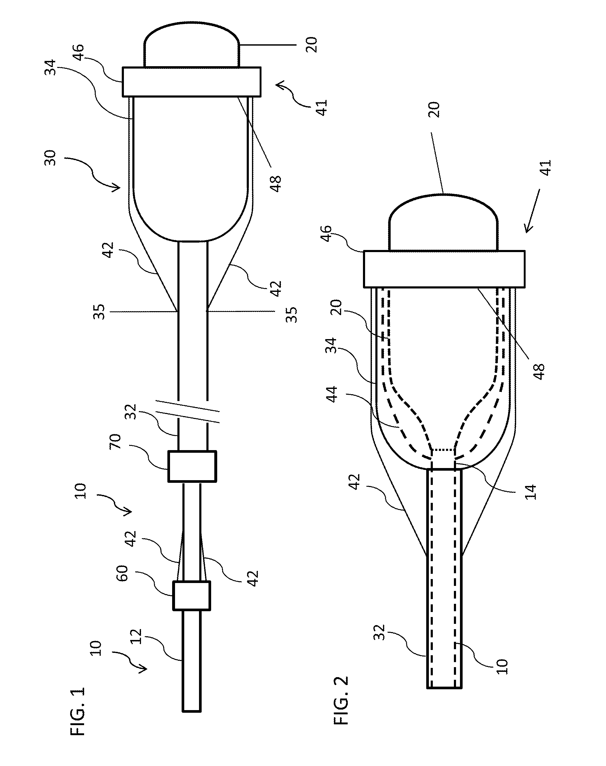 Adjustable length dilation balloon