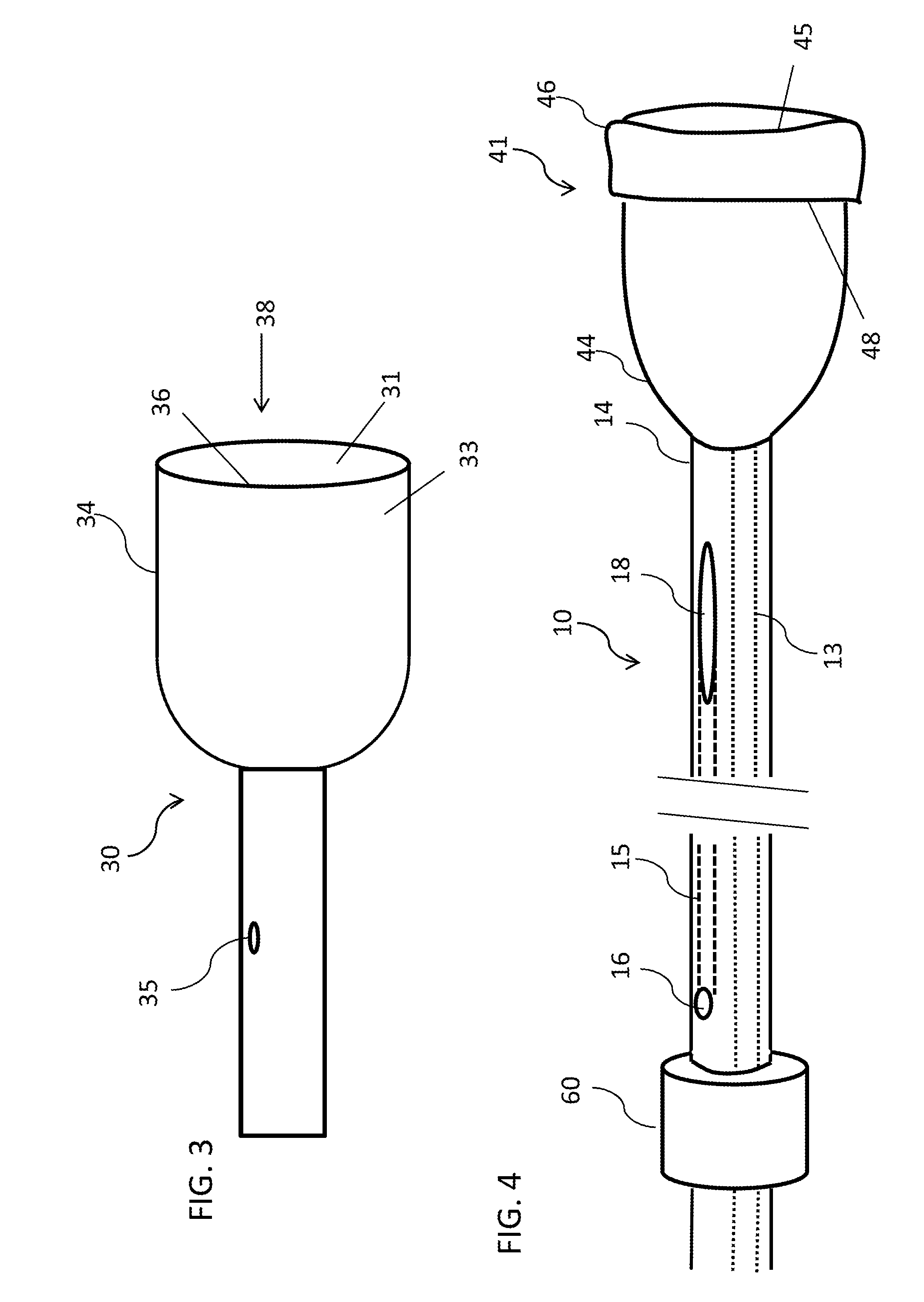 Adjustable length dilation balloon