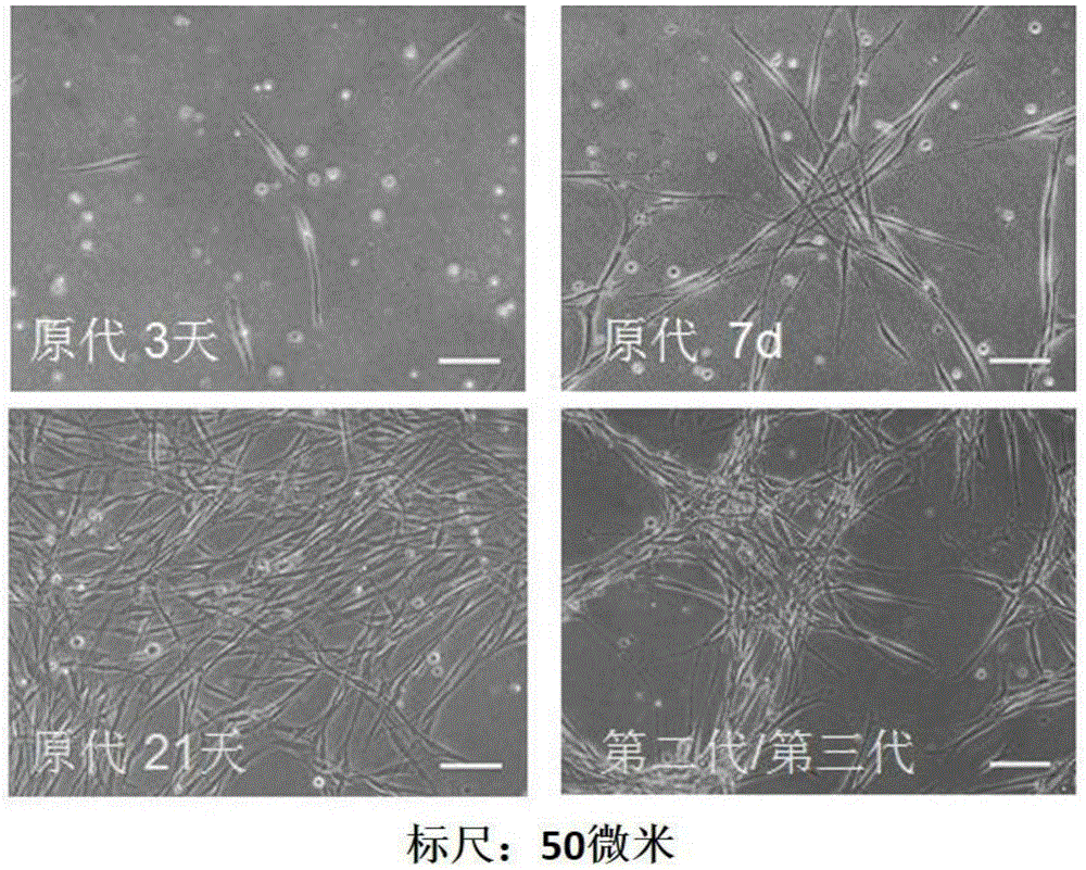 Separation and culture method and application of human testis mesenchymal stem cells
