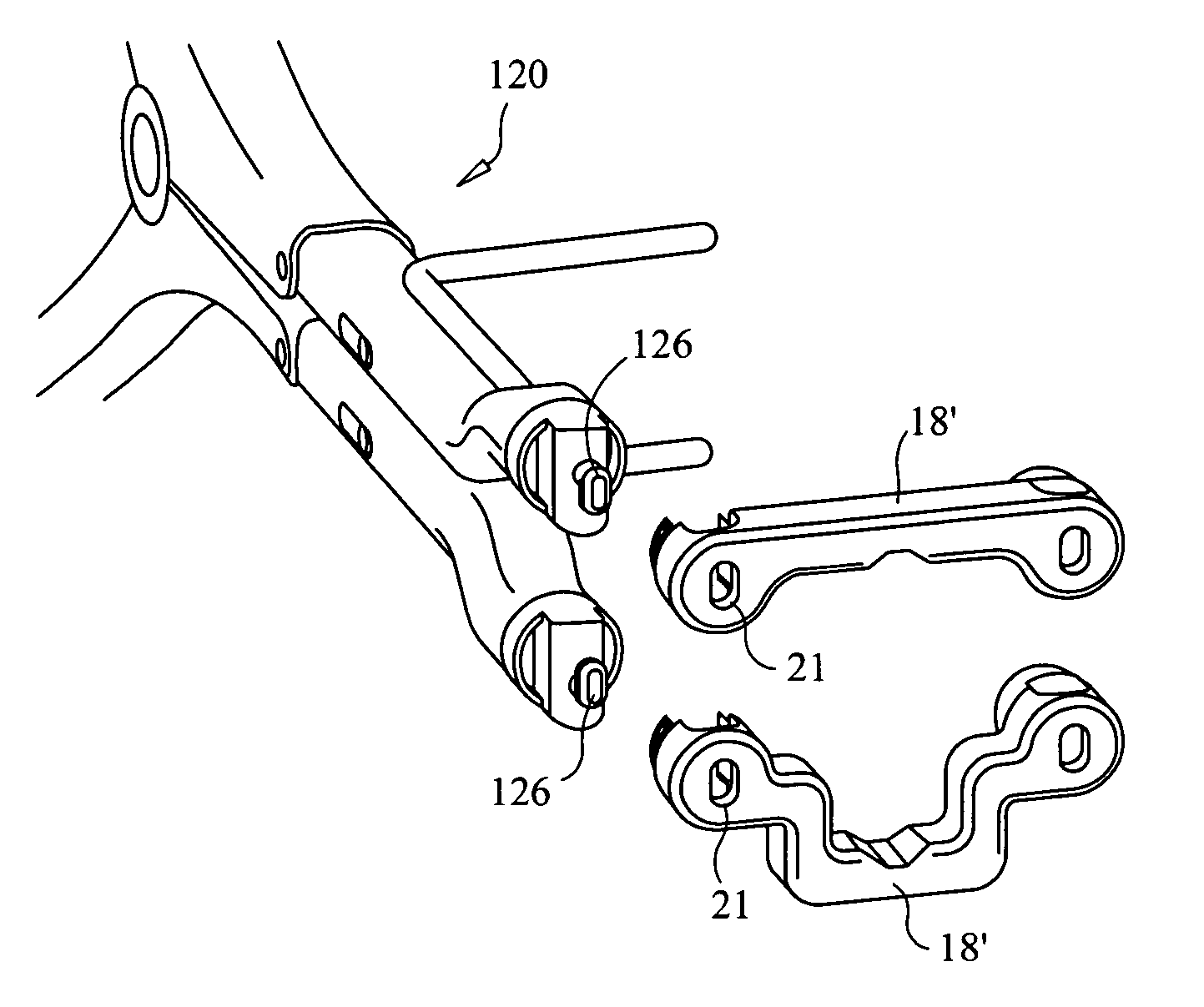 Interspinous implant, tools and methods of implanting