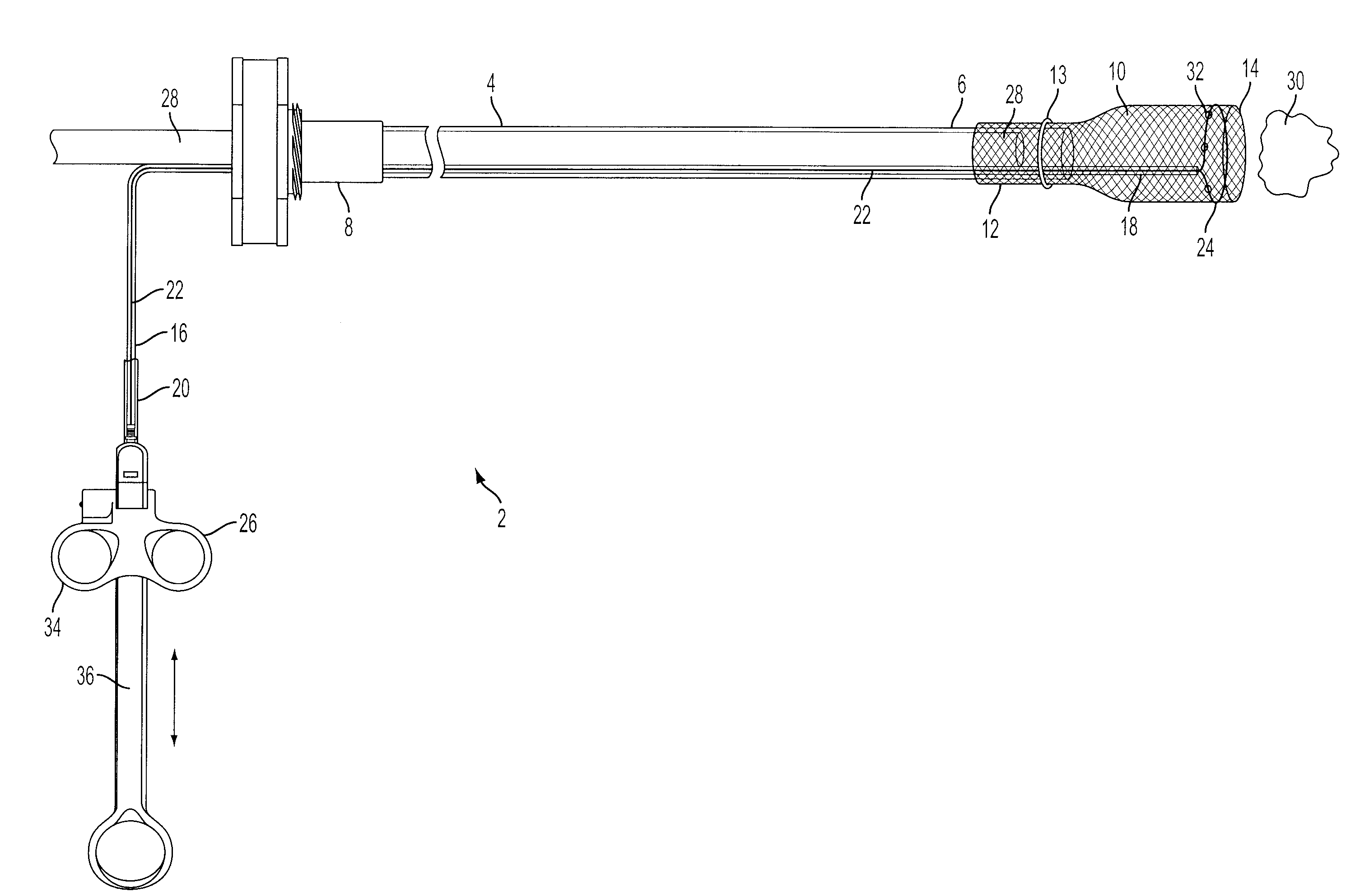 Apparatus and method for removal of foreign matter from a patient