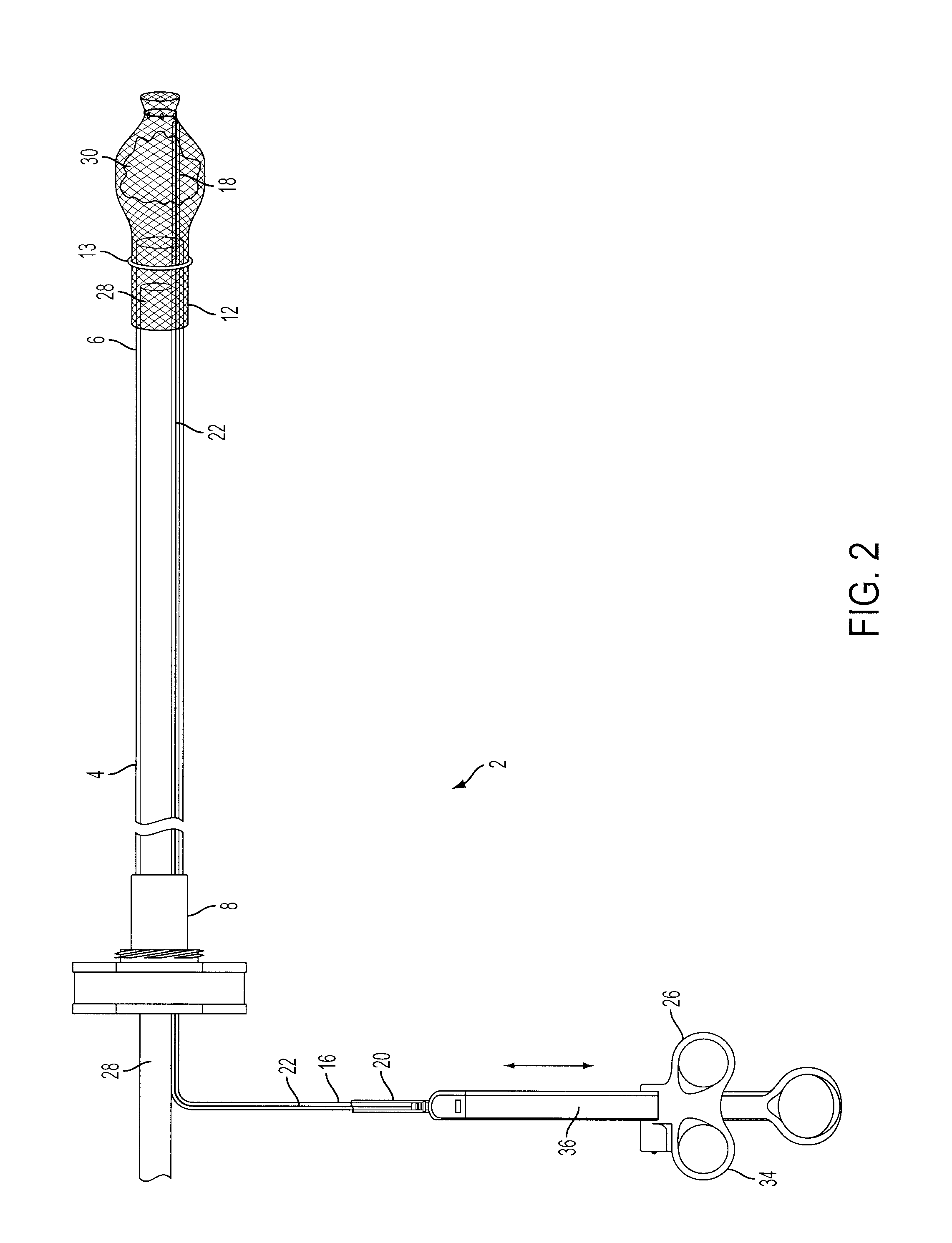 Apparatus and method for removal of foreign matter from a patient