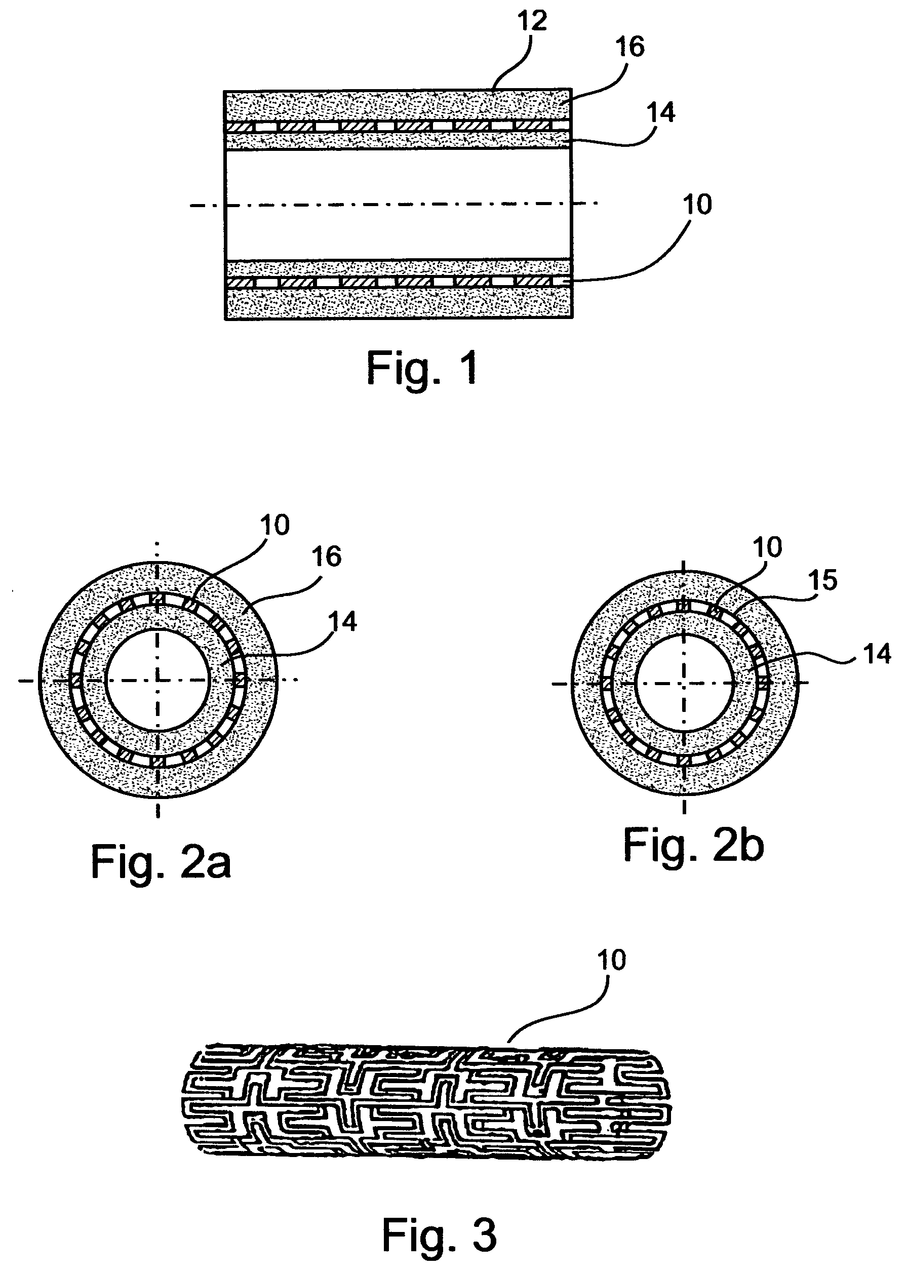Medicated polymer-coated stent assembly