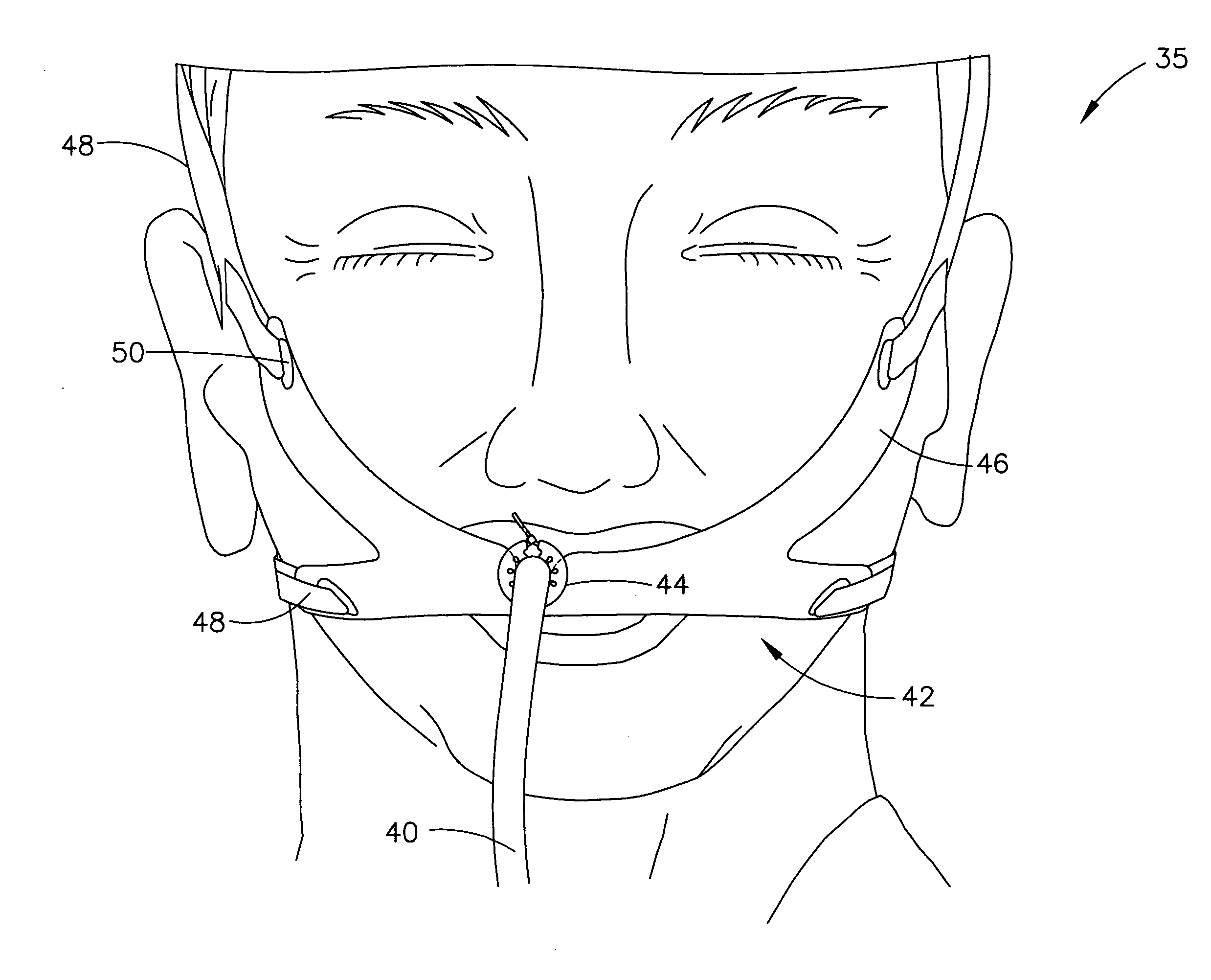 Adjustable collar and retainer for endotracheal tube