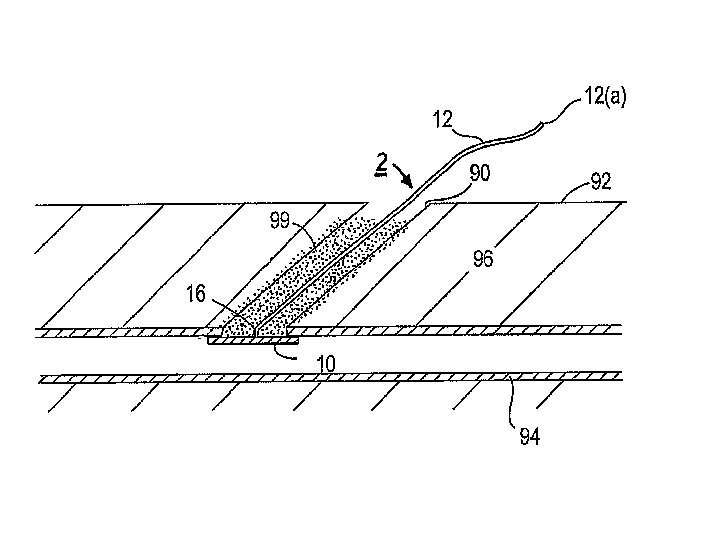 Apparatus and methods for facilitating hemostasis within a vascular puncture