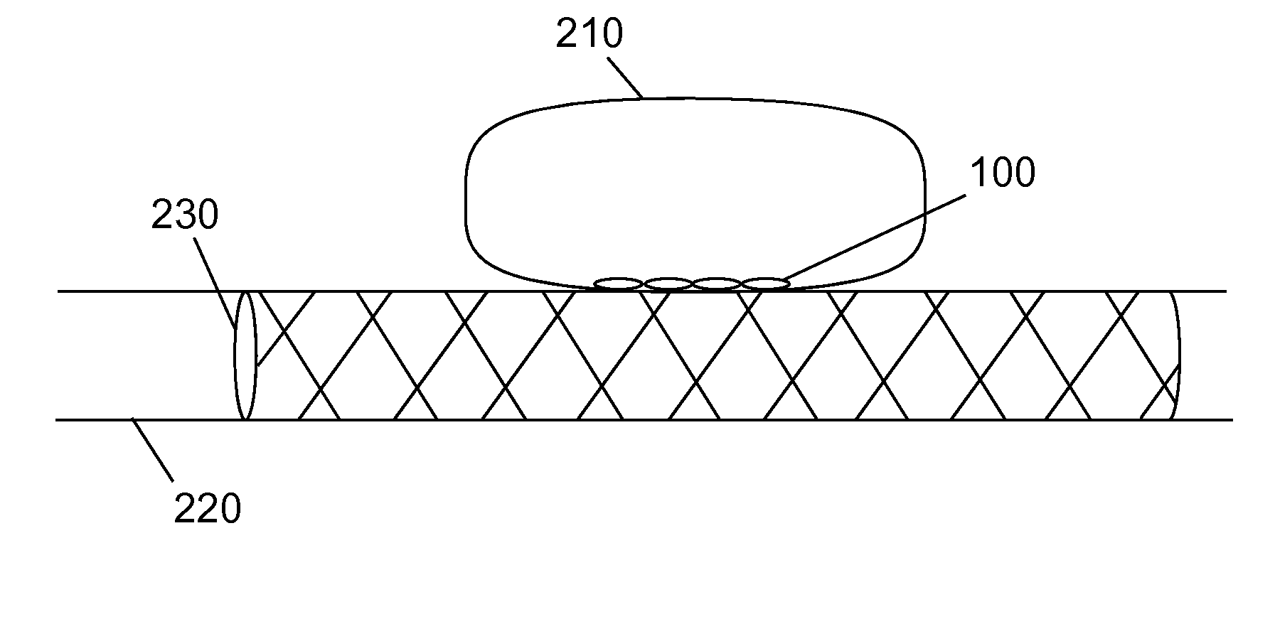 System and stent for repairing endovascular defects and methods of use