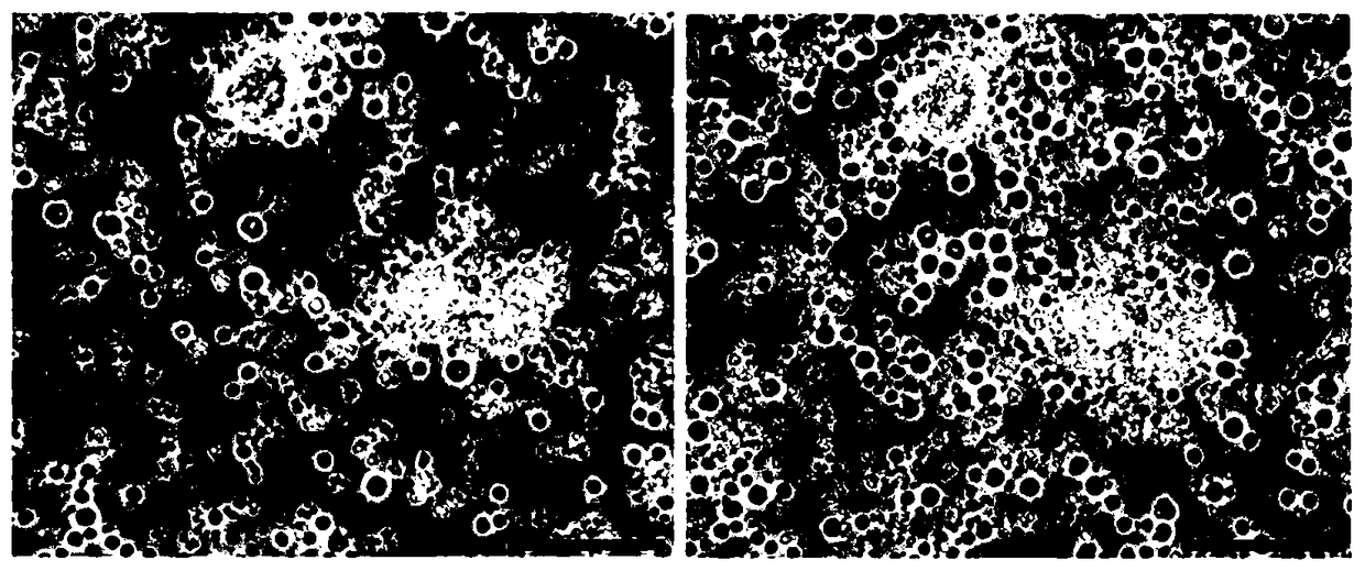 Application of umbilical cord blood regeneration particles and composition thereof to skin wound healing therapy