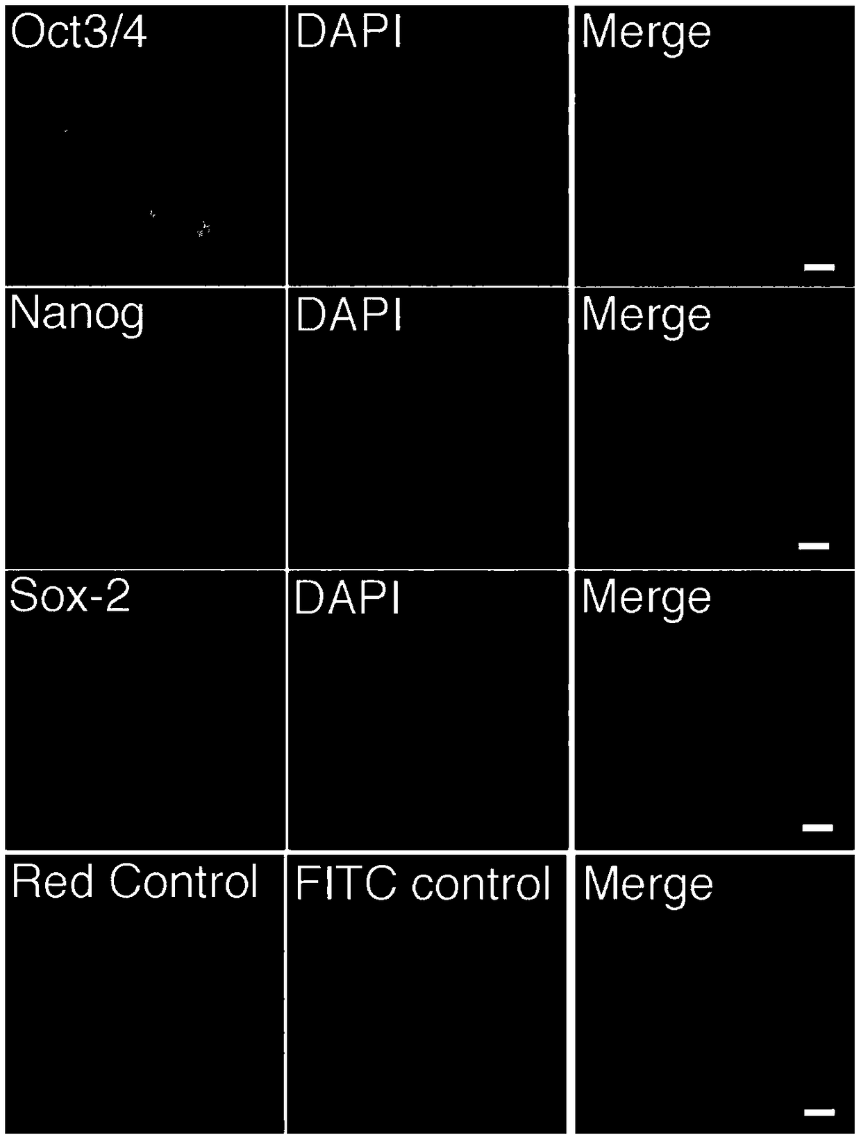 Application of umbilical cord blood regeneration particles and composition thereof to skin wound healing therapy