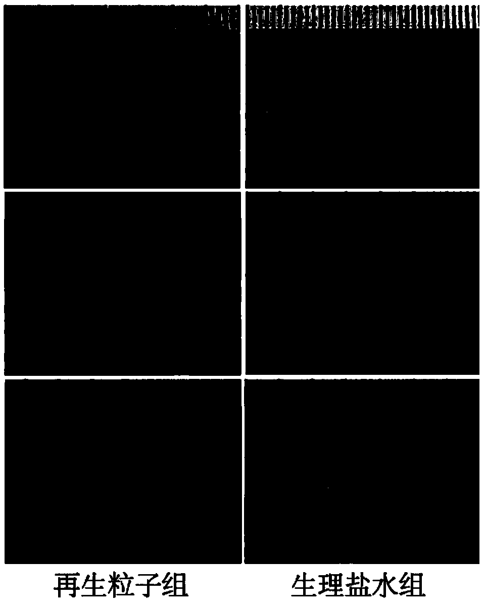 Application of umbilical cord blood regeneration particles and composition thereof to skin wound healing therapy